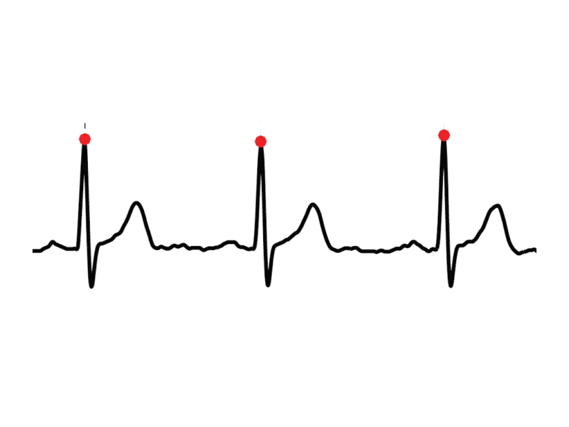 Beat-to-beat analysis